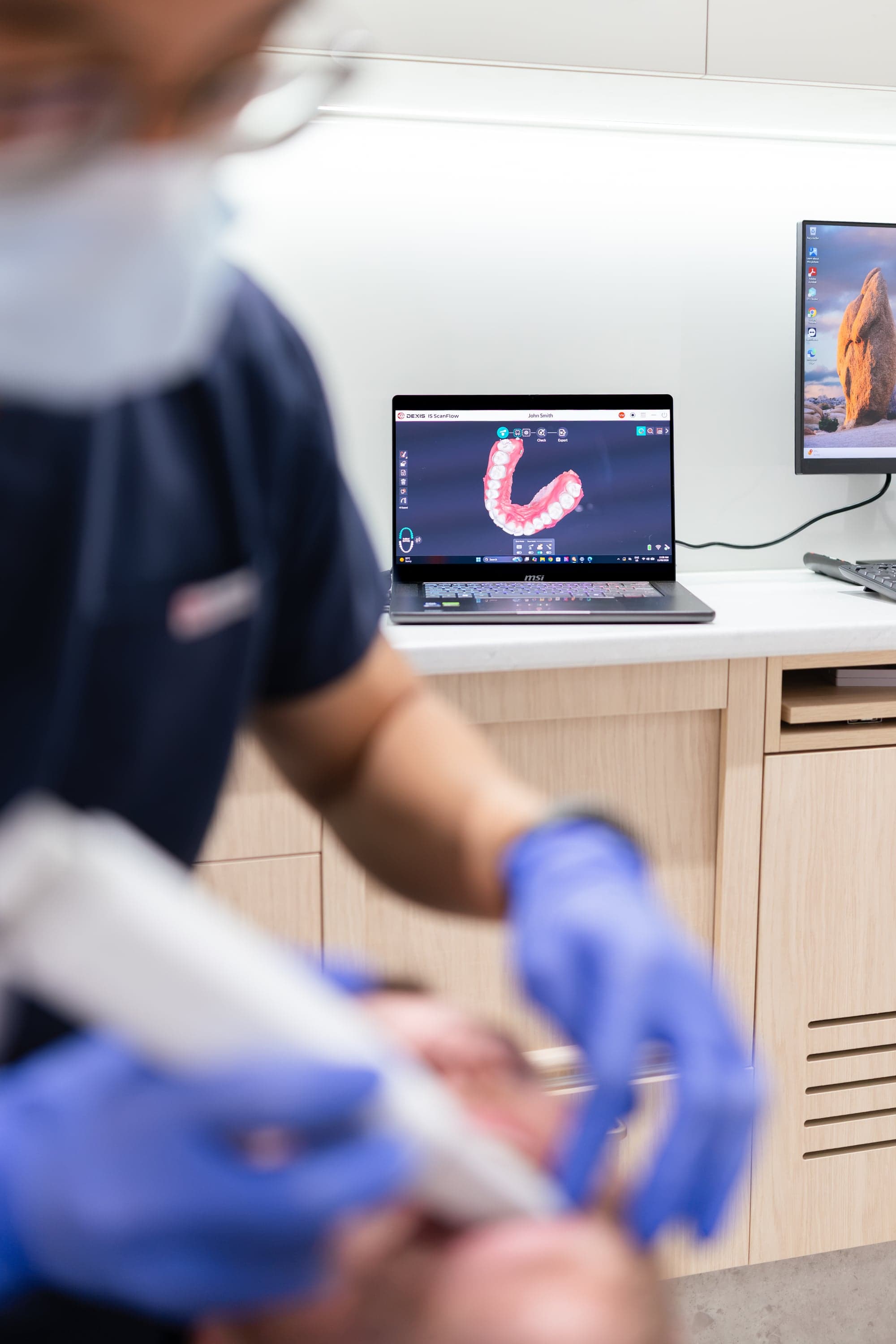 Dentist explaining root canal treatment options on a tablet