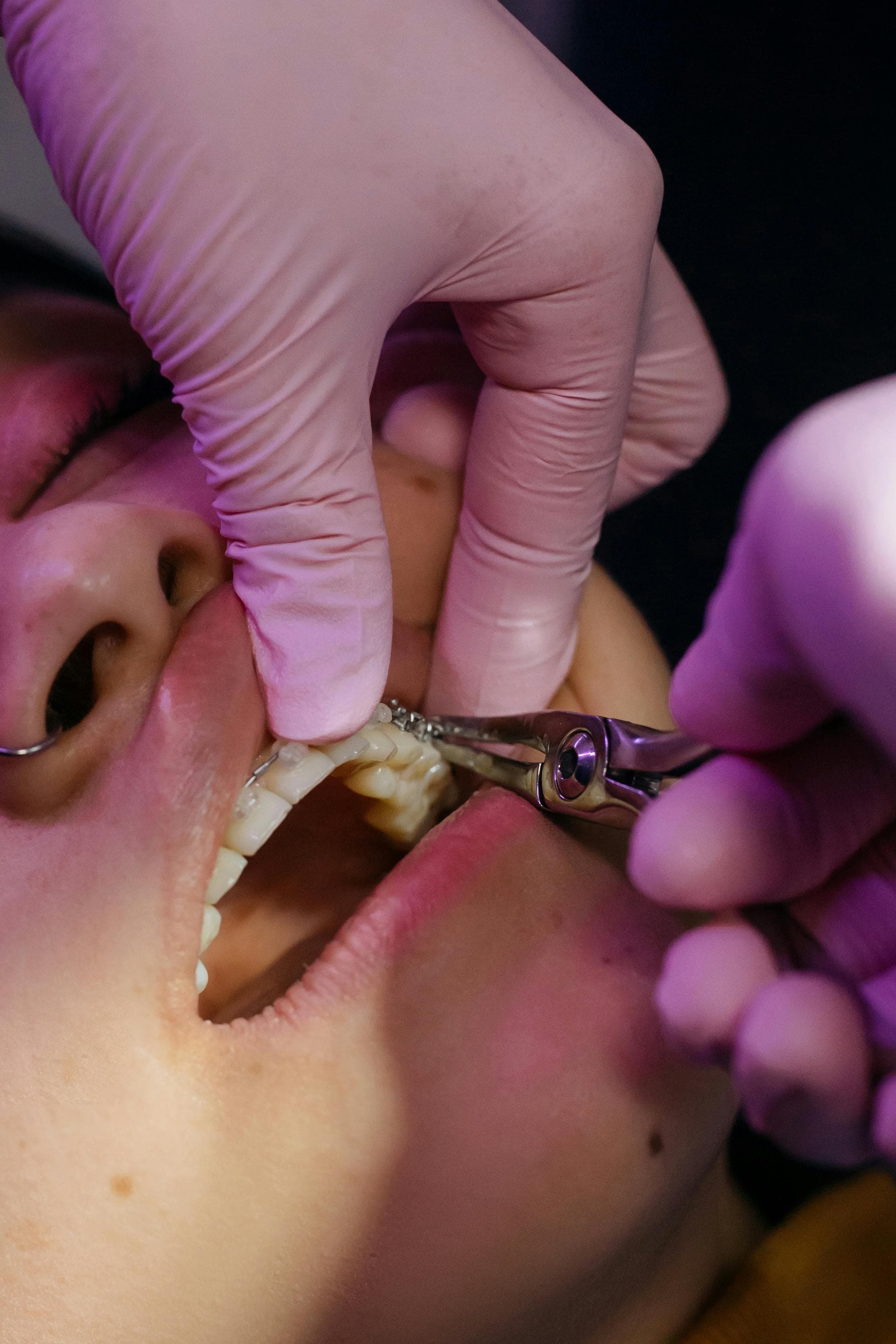 Dentist providing treatment with a personalised plan at Joyner Family Dental
